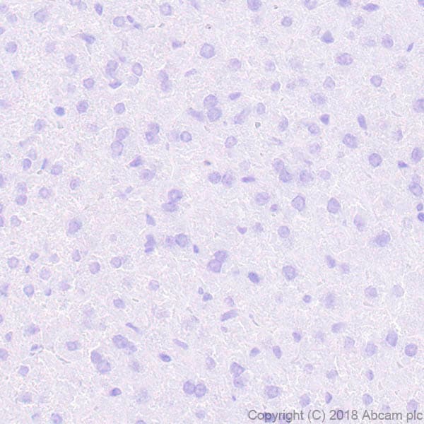 Anti-VGluT1 antibody [EPR22269](ab227805)