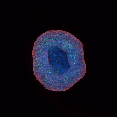 Hepg2 Spheroid Acquired At 10x Magnification