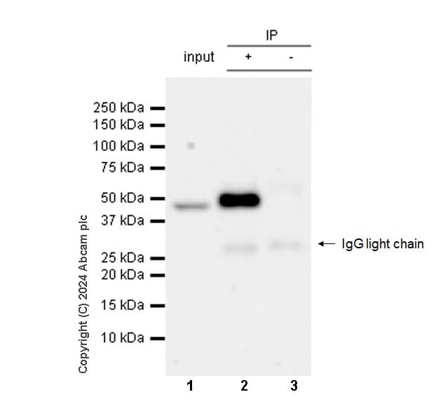 Mouse IgG1, kappa monoclonal [MOPC-21] - isotype control(AB18443)