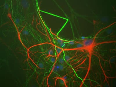 Anti-GFAP antibody [2A5](AB4648)