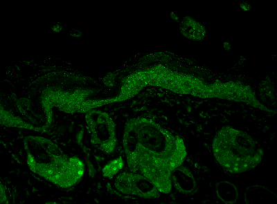 Hsp70 Antibody N27f3 4 Ab47454  Immunohistochemistry Formalin Pfa Fixed Paraffin Embedded Sections Img104979