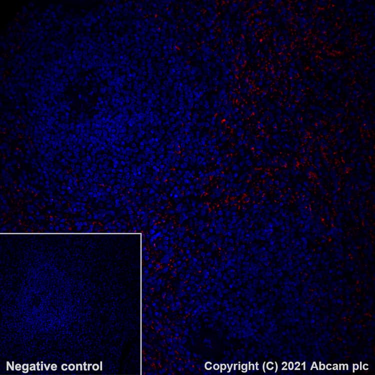Alexa Fluor 647 Pf4 Antibody Epr7763 Ab280969  Immunohistochemistry Formalin Pfa Fixed Paraffin Embedded Sections Img132721
