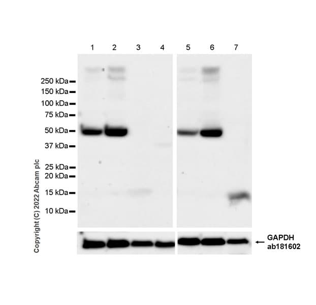 Gaba A Receptor Alpha 2 Gabra2 Antibody Epr26485 185 Bsa And Azide Free Ab307360  Western Blot Img405550