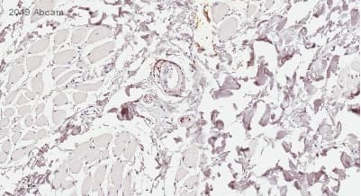 Anti-PGP9.5 antibody [EPR4118] - Neuronal Marker(AB108986)