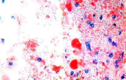 Oil Red O Stain Kit (Lipid Stain)(AB150678)