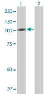 Reck Antibody Ab88249  Western Blot Img142224