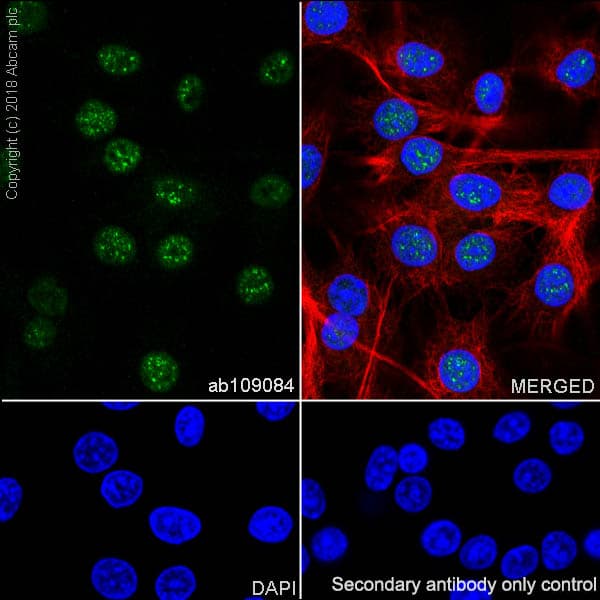Anti-RPA32/RPA2 antibody [EPR2876(2)](AB109084)