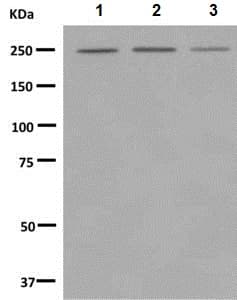 Anti-Myosin VIIa/MYO7A antibody [EPR7497](AB150386)