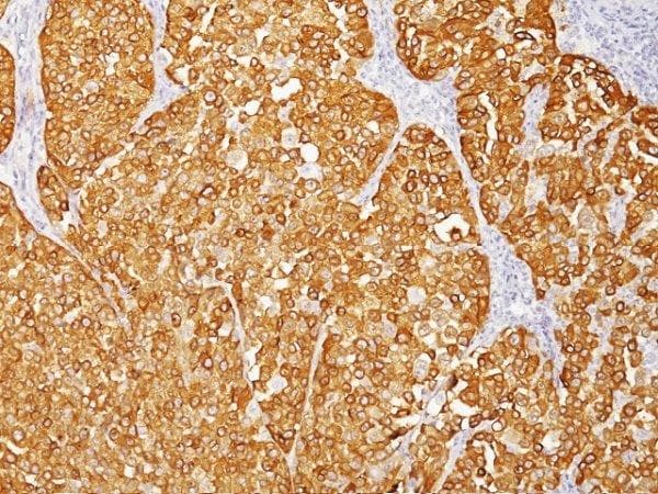 Anti-Melanoma antibody [HMB45 + M2-7C10 + M2-9E3 + T311](AB733)