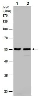 Anti-Calreticulin antibody(AB227444)