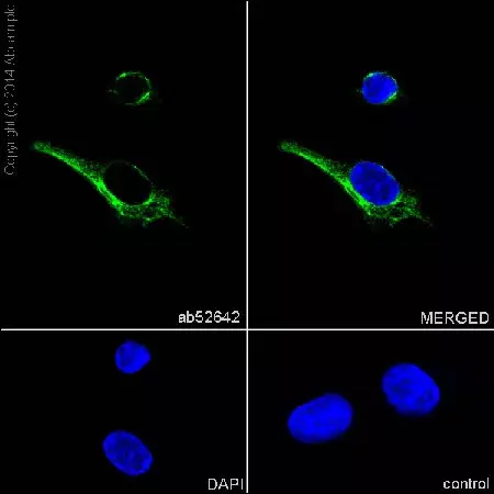 Anti-S100 beta antibody [EP1576Y] - Astrocyte Marker(AB52642)