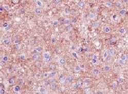 Anti-Homer1 antibody [EPR15309] - BSA and Azide free(AB232668)