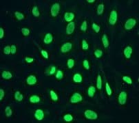 Chd3 Antibody Epncir110a Bsa And Azide Free Ab240942  Immunocytochemistry Immunofluorescence Img133392