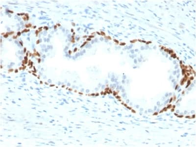 Anti-p63 antibody [TP63/2428](AB238080)