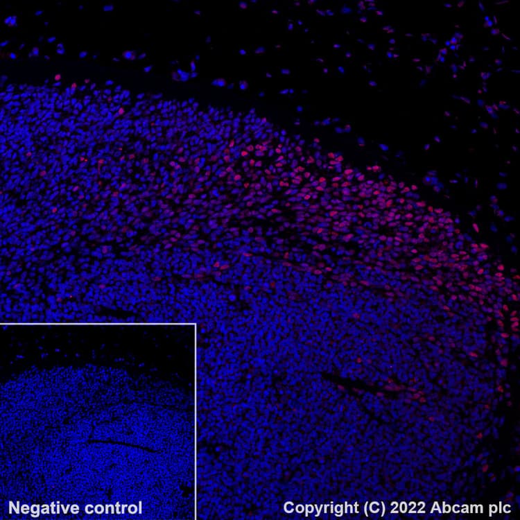 Alexa Fluor® 647 Anti-BRN3A antibody [EPR23257-285](AB300744)