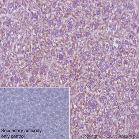 Anti-MMP3 antibody [EP1186Y](AB52915)