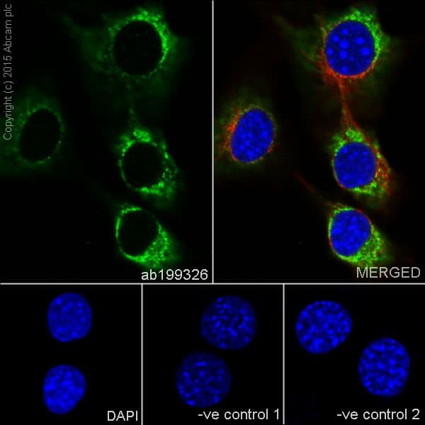 Anti-ATP6V1A antibody [EPR19270] - BSA and Azide free(AB251267)