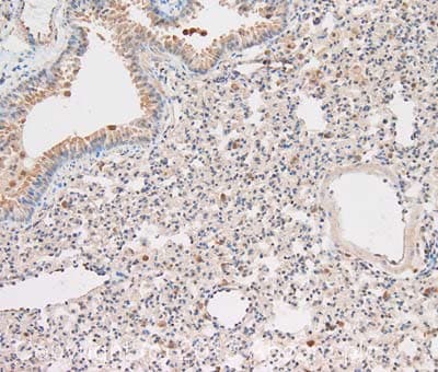 Anti-Caspase-1 antibody(AB138483)