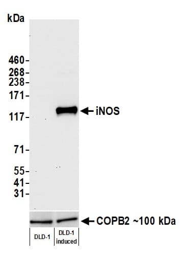 Inos Antibody Blr188j Bsa Free Ab314088  Western Blot Img420588