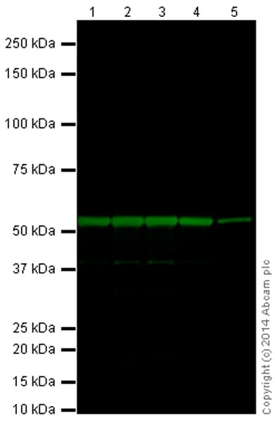 Anti-beta III Tubulin antibody [EP1569Y] - Neuronal Marker(AB52623)