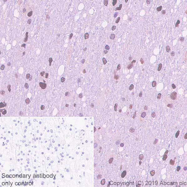 Rpa32 Rpa2 Antibody Epr22950 81 Ab240637  Immunohistochemistry Formalin Pfa Fixed Paraffin Embedded Sections Img93857