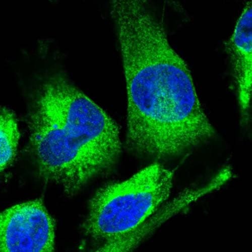 Kctd20 Antibody Ab122094  Immunocytochemistry Immunofluorescence Img38396