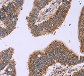 Anti-Interferon alpha 2 antibody(AB198914)