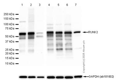 Anti-RUNX2 antibody [EPR14334](AB192256)