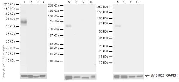 Anti-FOXG1 antibody [EPR18987](AB196868)