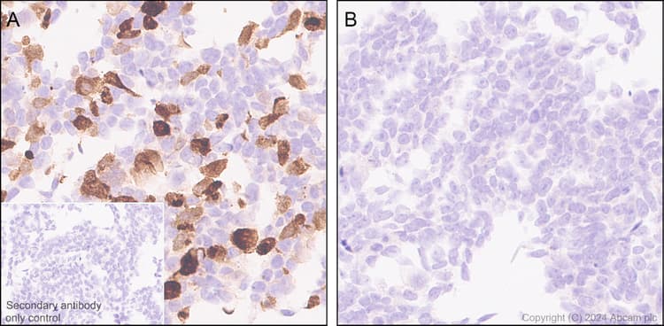 Cholera Enterotoxin Subunit B Antibody Epr27372 4 Ab317738  Immunohistochemistry Formalin Pfa Fixed Paraffin Embedded Sections Img432107