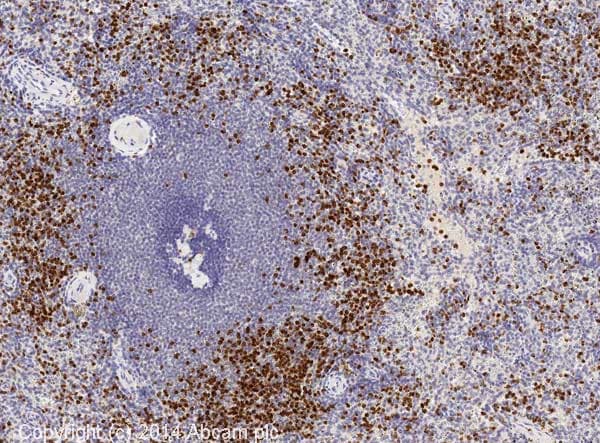 Anti-Neutrophil Elastase antibody(AB68672)