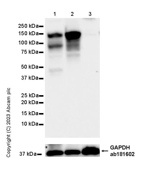 Mda5 Antibody Epr28350 21 Ab315242  Western Blot Img424420