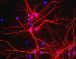 Anti-MAP2 antibody(AB92434)