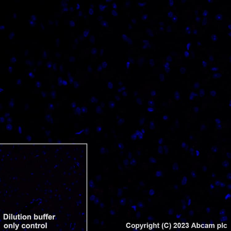 Alexa Fluor® 555 Anti-CD4 antibody [EPR19514](AB313727)