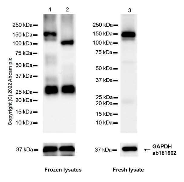 Semaphorin 4d Cd100 Antibody 30 Cd100 Ab307685  Western Blot Img408436