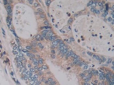 Anti-Kallikrein 2/KLK2 antibody(ab232980)