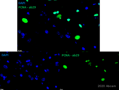 Anti-PCNA antibody [PC10](AB29)