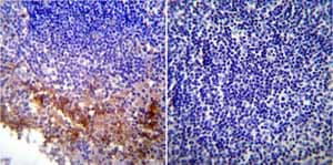 Kdel Antibody Ab2898  Immunohistochemistry Formalin Pfa Fixed Paraffin Embedded Sections Img95078