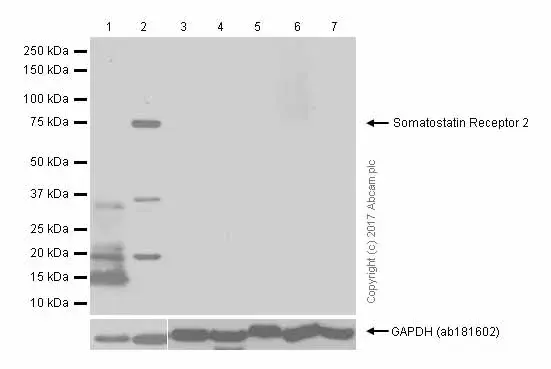 Anti-Somatostatin Receptor 2 antibody [UMB1] - C-terminal(AB134152)