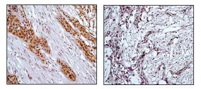 Rsk1 P90 Phospho T359 Antibody E238 Bsa And Azide Free Ab171376  Immunohistochemistry Formalin Pfa Fixed Paraffin Embedded Sections Img131115