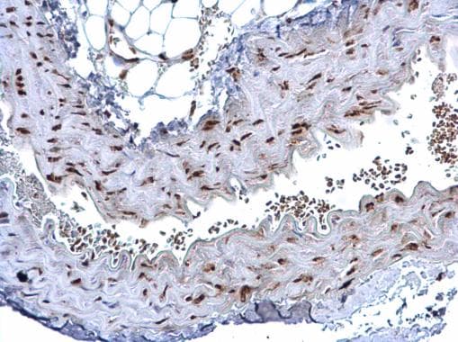 Hmgb1 Antibody N Terminal Ab228624  Immunohistochemistry Formalin Pfa Fixed Paraffin Embedded Sections Img134325