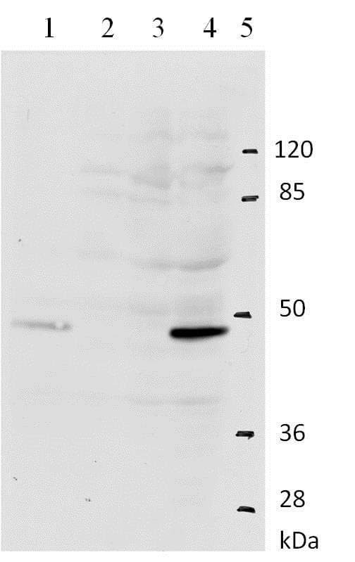 Hpv11 E2 Antibody 10e12 Ab100968  Western Blot Img15656