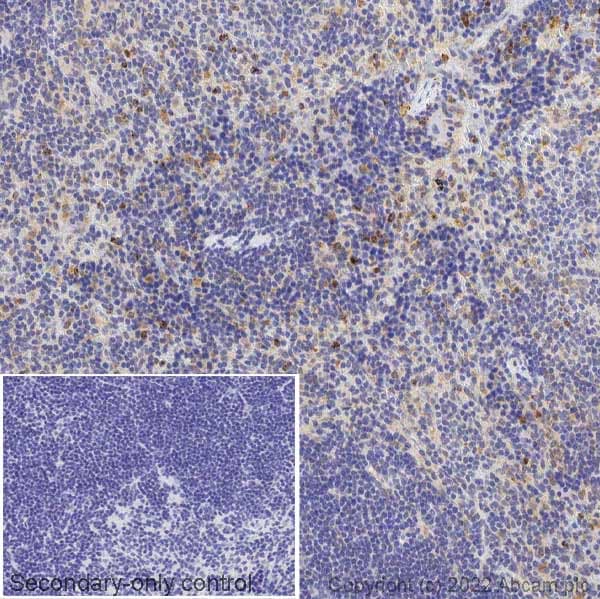 Anti-Neutrophil Elastase antibody(AB68672)