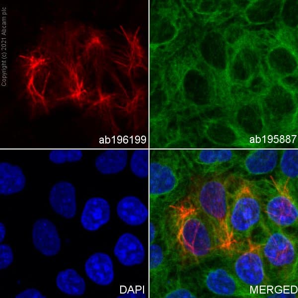 Alexa Fluor® 647 Anti-Cytokeratin 17 antibody [EP1623] - Cytoskeleton Marker(AB196199)