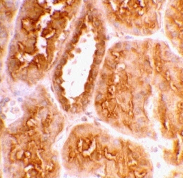 Anti-ACE2 antibody(AB15348)