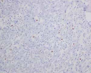 Anti-S100P antibody [EPR6142](AB124743)