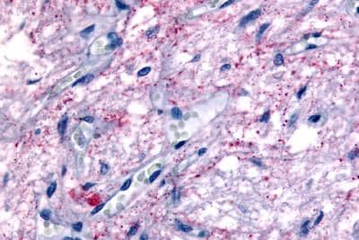 Melatonin Related Receptor Antibody Ab189051  Immunohistochemistry Formalin Pfa Fixed Paraffin Embedded Sections Img31679