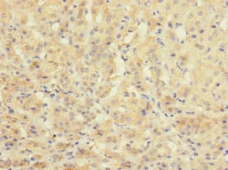 Anti-C20orf112/NOL4L antibody(ab237758)