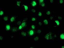Samhd1 Antibody Oti1a1 Ab128107  Immunocytochemistry Immunofluorescence Img73798