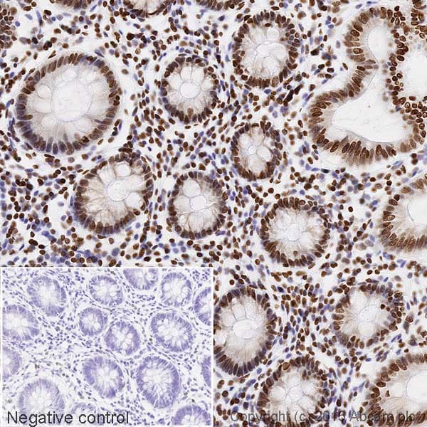 Biotin Anti-Histone H3 (acetyl K14) antibody [EP964Y](AB200031)
